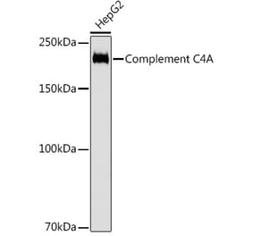 Western Blot - Anti-C4a Antibody [ARC2037] (A306227) - Antibodies.com