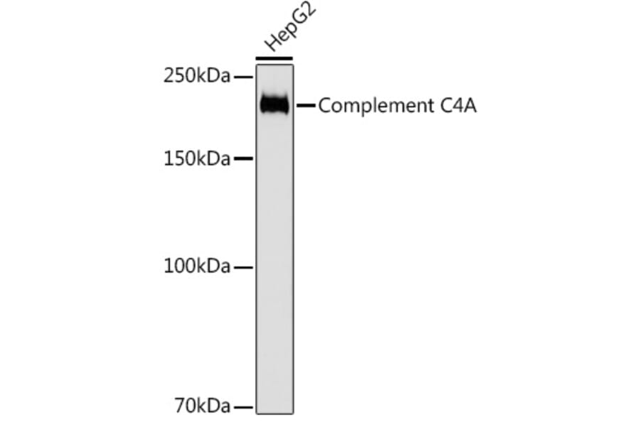 Western Blot - Anti-C4a Antibody [ARC2037] (A306227) - Antibodies.com