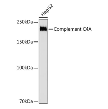 Western Blot - Anti-C4a Antibody [ARC2037] (A306227) - Antibodies.com