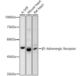 Western Blot - Anti-beta 1 Adrenergic Receptor Antibody (A306228) - Antibodies.com