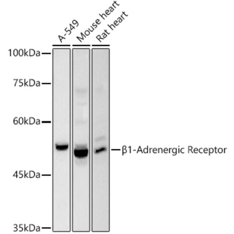 Western Blot - Anti-beta 1 Adrenergic Receptor Antibody (A306228) - Antibodies.com