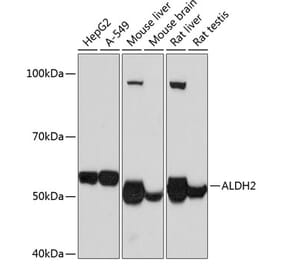 Western Blot - Anti-ALDH2 Antibody [ARC0623] (A306229) - Antibodies.com