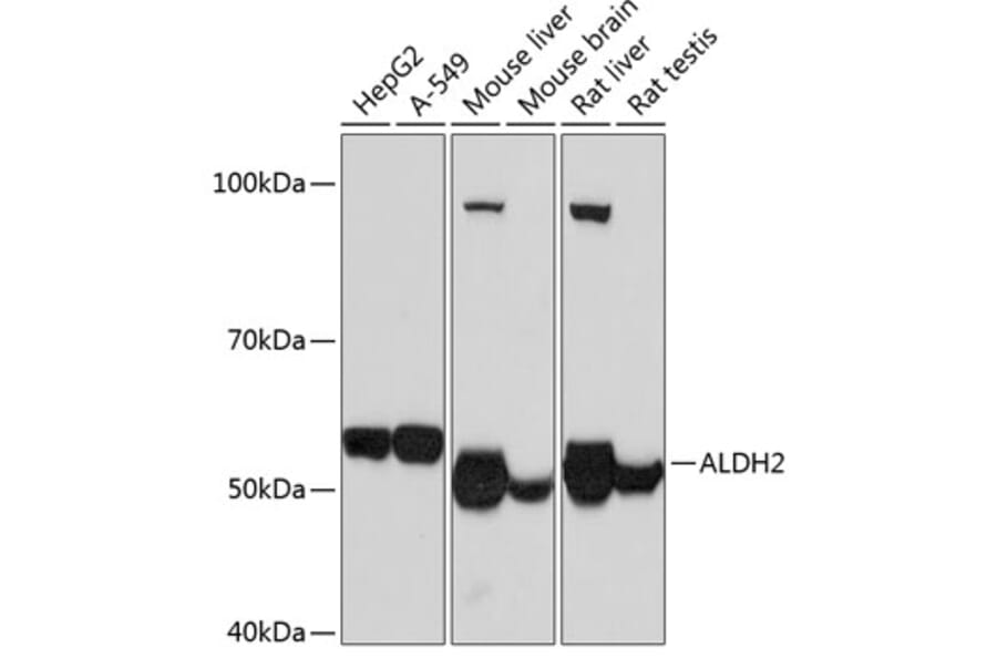 Western Blot - Anti-ALDH2 Antibody [ARC0623] (A306229) - Antibodies.com