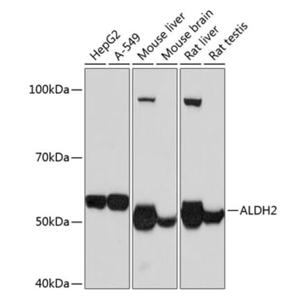 Western Blot - Anti-ALDH2 Antibody [ARC0623] (A306229) - Antibodies.com