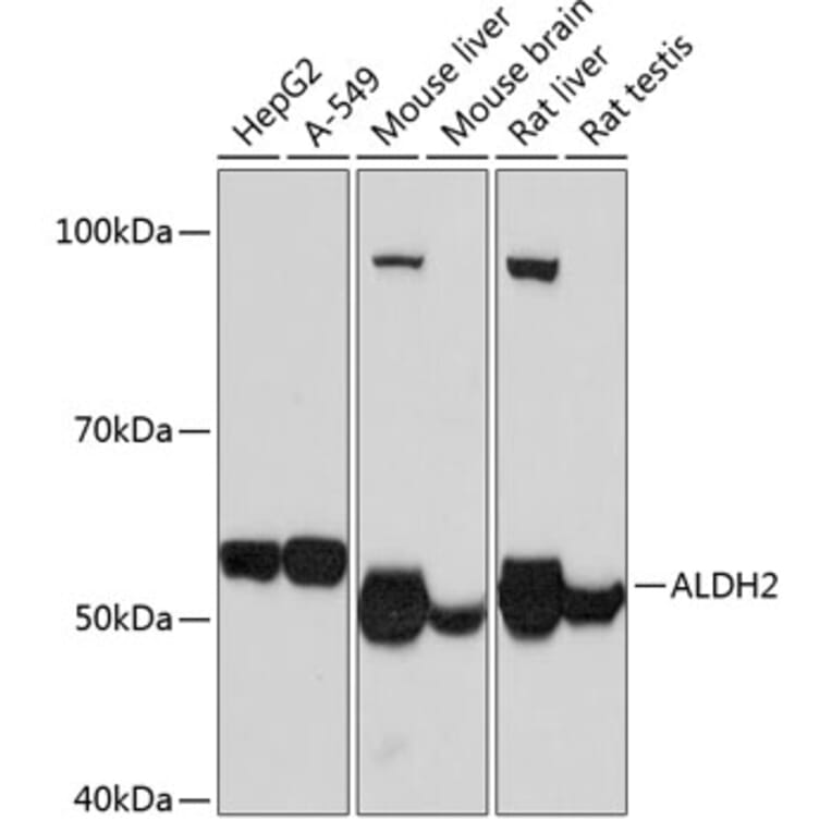 Western Blot - Anti-ALDH2 Antibody [ARC0623] (A306229) - Antibodies.com