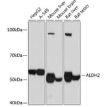 Western Blot - Anti-ALDH2 Antibody [ARC0623] (A306229) - Antibodies.com
