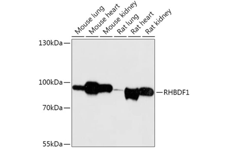 Western Blot - Anti-RHBDF1 Antibody (A306230) - Antibodies.com