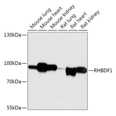 Western Blot - Anti-RHBDF1 Antibody (A306230) - Antibodies.com