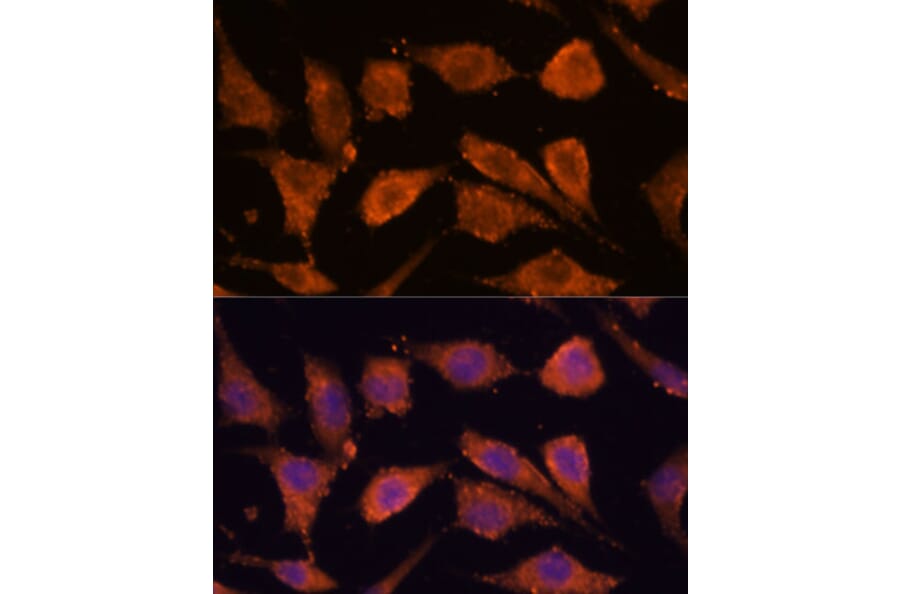 Immunofluorescence - Anti-RHBDF1 Antibody (A306230) - Antibodies.com
