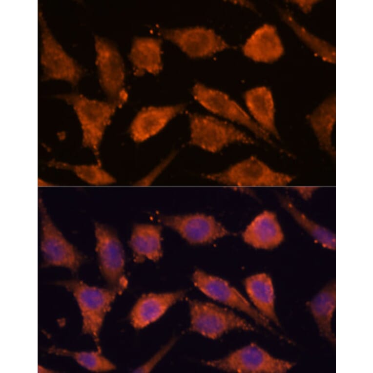 Immunofluorescence - Anti-RHBDF1 Antibody (A306230) - Antibodies.com
