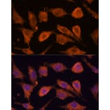 Immunofluorescence - Anti-RHBDF1 Antibody (A306230) - Antibodies.com