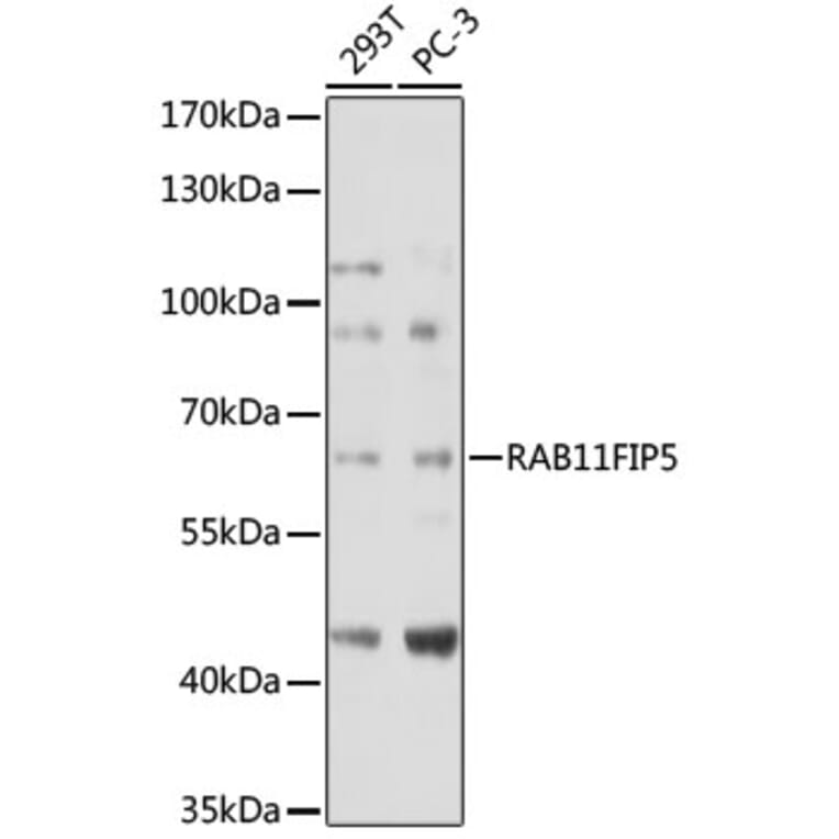 Western Blot - Anti-RAB11FIP5 Antibody (A306231) - Antibodies.com