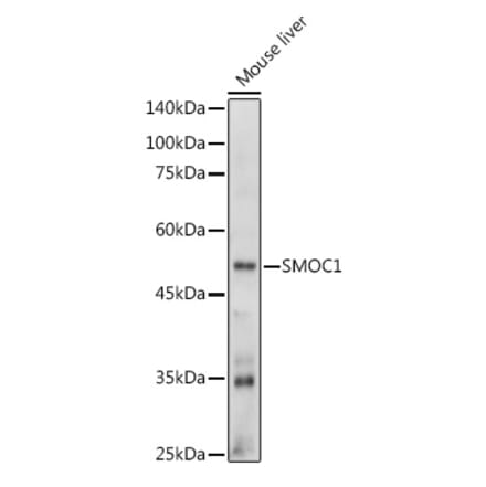 Western Blot - Anti-SMOC1 Antibody (A306232) - Antibodies.com
