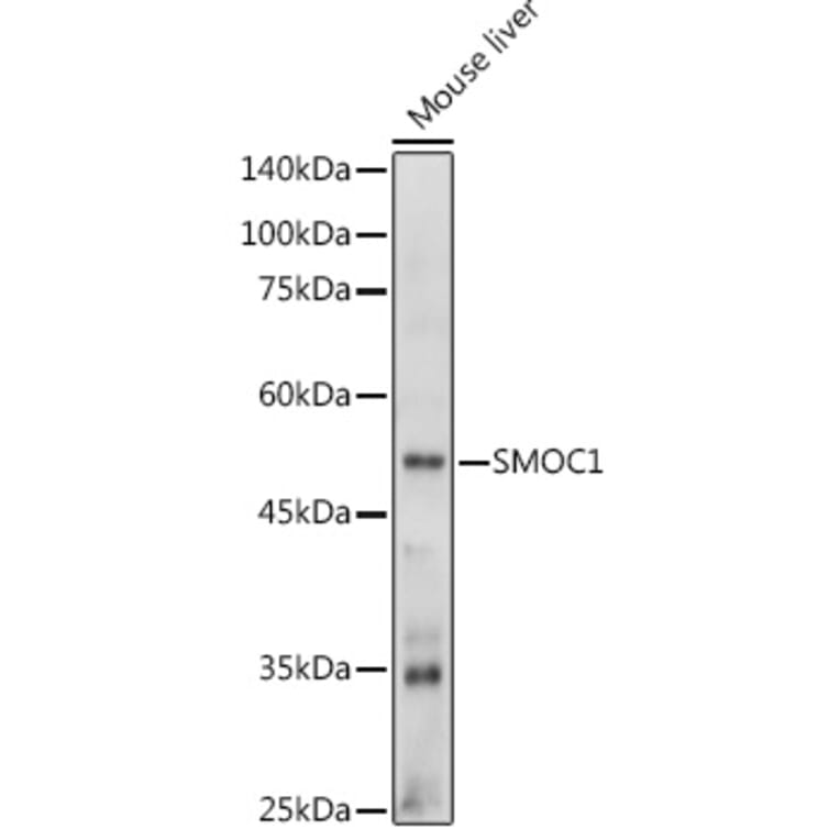 Western Blot - Anti-SMOC1 Antibody (A306232) - Antibodies.com
