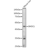 Western Blot - Anti-SMOC1 Antibody (A306232) - Antibodies.com