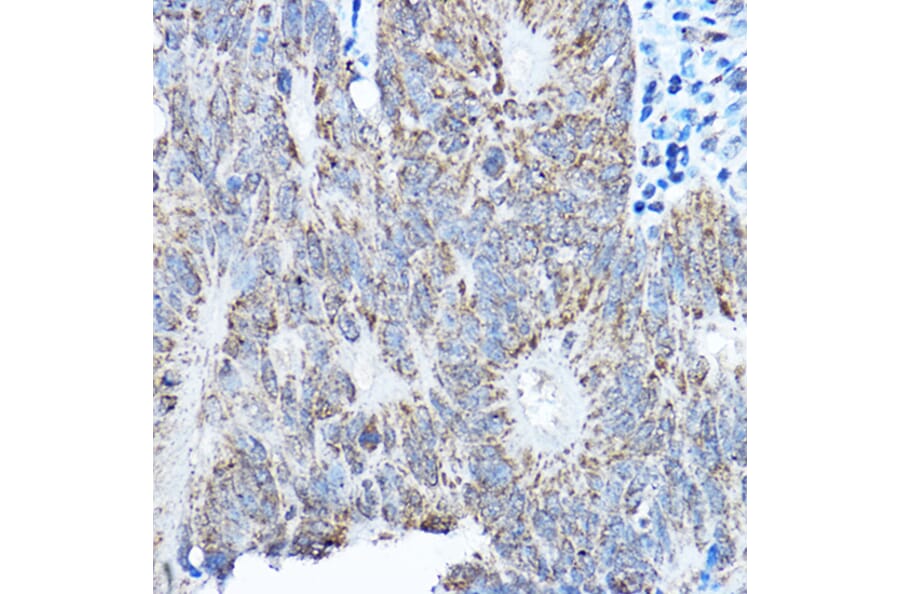 Immunohistochemistry - Anti-SMOC1 Antibody (A306232) - Antibodies.com