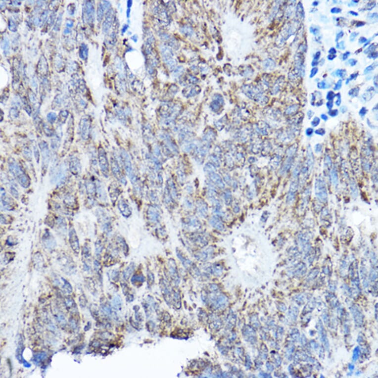 Immunohistochemistry - Anti-SMOC1 Antibody (A306232) - Antibodies.com