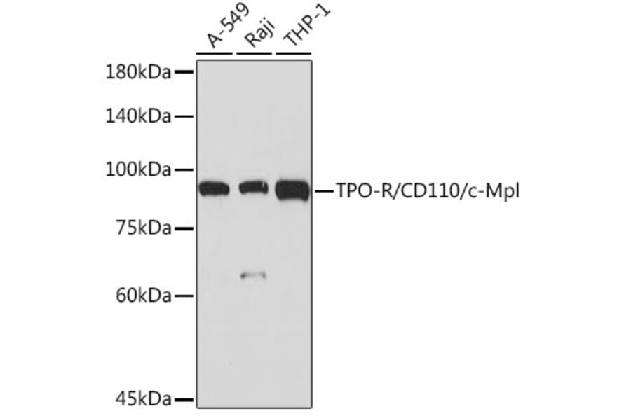 Western Blot - Anti-TPOR/MPL Antibody [ARC2257] (A306233) - Antibodies.com