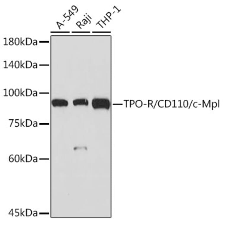Western Blot - Anti-TPOR/MPL Antibody [ARC2257] (A306233) - Antibodies.com