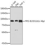 Western Blot - Anti-TPOR/MPL Antibody [ARC2257] (A306233) - Antibodies.com
