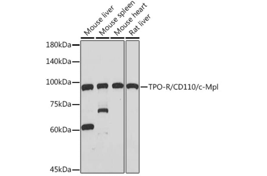 Western Blot - Anti-TPOR/MPL Antibody [ARC2257] (A306233) - Antibodies.com