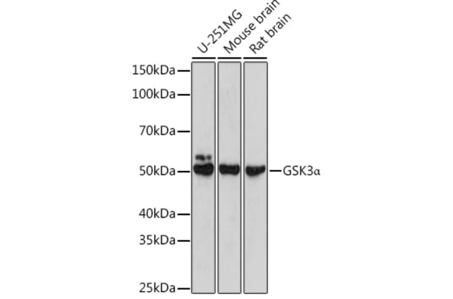 Western Blot - Anti-GSK3 alpha Antibody (A306234) - Antibodies.com