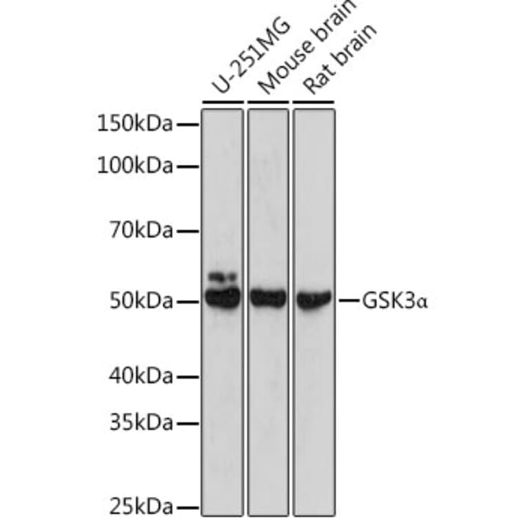 Western Blot - Anti-GSK3 alpha Antibody (A306234) - Antibodies.com