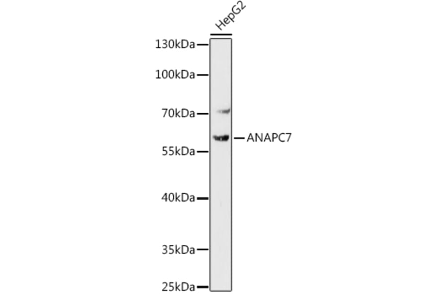 Western Blot - Anti-Apc7 Antibody (A306236) - Antibodies.com