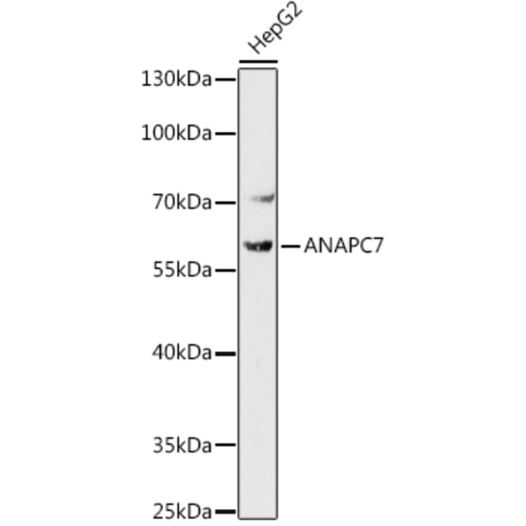 Western Blot - Anti-Apc7 Antibody (A306236) - Antibodies.com