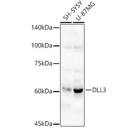 Western Blot - Anti-DLL3 Antibody (A306237) - Antibodies.com