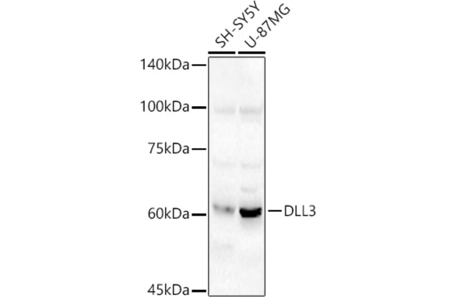 Western Blot - Anti-DLL3 Antibody (A306237) - Antibodies.com