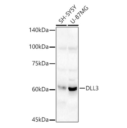 Western Blot - Anti-DLL3 Antibody (A306237) - Antibodies.com