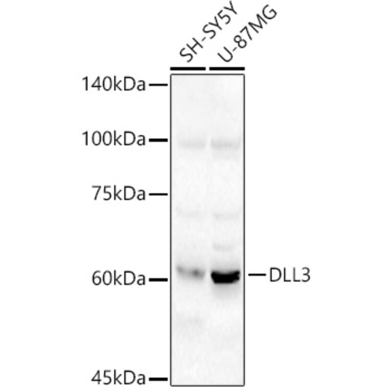 Western Blot - Anti-DLL3 Antibody (A306237) - Antibodies.com