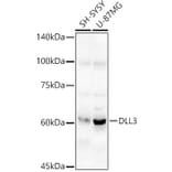 Western Blot - Anti-DLL3 Antibody (A306237) - Antibodies.com