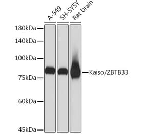 Western Blot - Anti-Kaiso Antibody [ARC2086] (A306238) - Antibodies.com