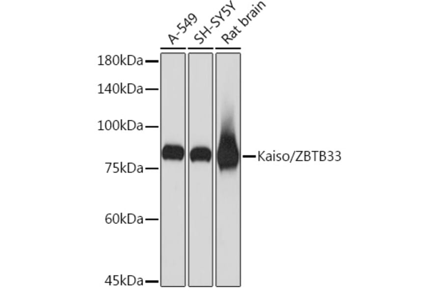 Western Blot - Anti-Kaiso Antibody [ARC2086] (A306238) - Antibodies.com