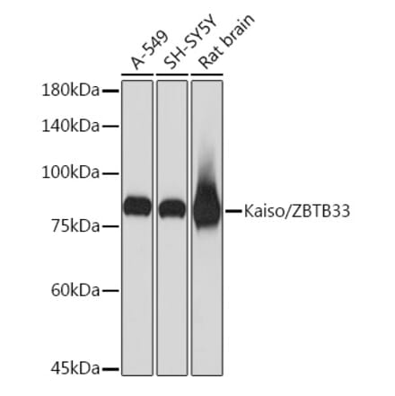 Western Blot - Anti-Kaiso Antibody [ARC2086] (A306238) - Antibodies.com