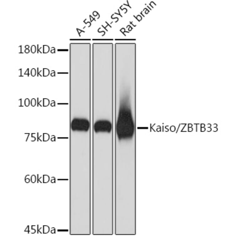 Western Blot - Anti-Kaiso Antibody [ARC2086] (A306238) - Antibodies.com