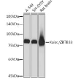 Western Blot - Anti-Kaiso Antibody [ARC2086] (A306238) - Antibodies.com