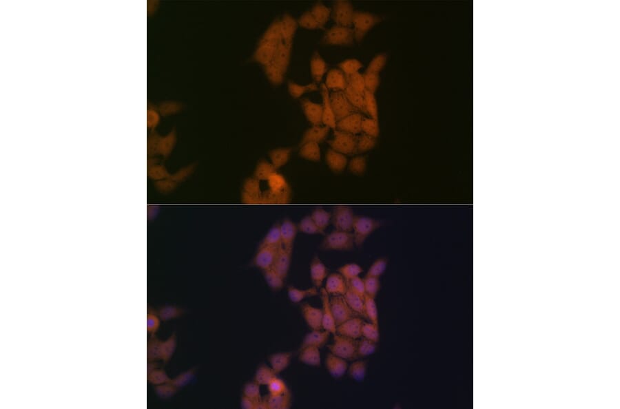 Immunofluorescence - Anti-Kaiso Antibody [ARC2086] (A306238) - Antibodies.com