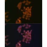 Immunofluorescence - Anti-Kaiso Antibody [ARC2086] (A306238) - Antibodies.com