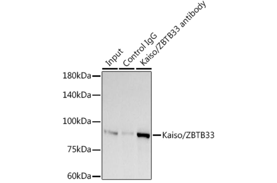 Western Blot - Anti-Kaiso Antibody [ARC2086] (A306238) - Antibodies.com