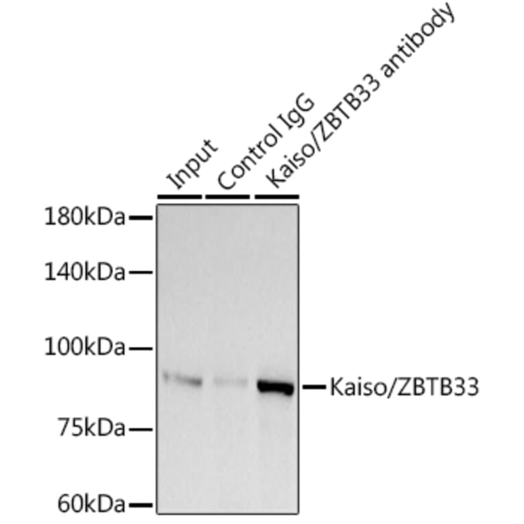 Western Blot - Anti-Kaiso Antibody [ARC2086] (A306238) - Antibodies.com