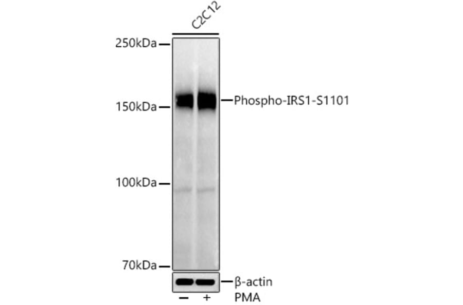 Western Blot - Anti-IRS1 (phospho Ser1101) Antibody (A306239) - Antibodies.com