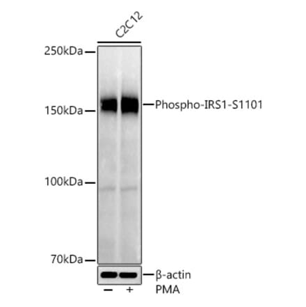 Western Blot - Anti-IRS1 (phospho Ser1101) Antibody (A306239) - Antibodies.com