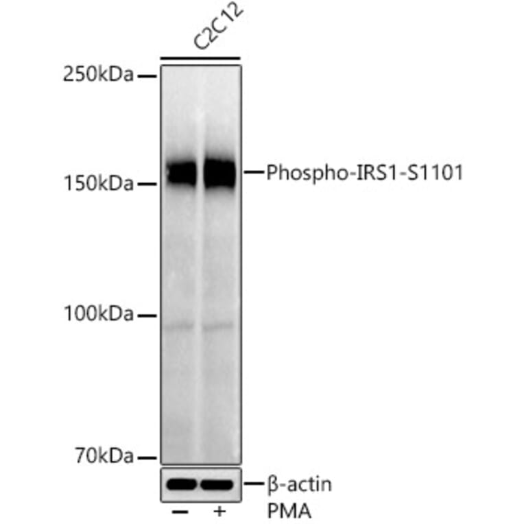 Western Blot - Anti-IRS1 (phospho Ser1101) Antibody (A306239) - Antibodies.com