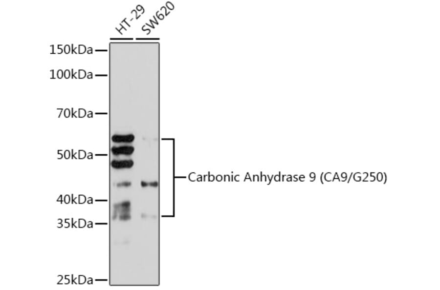 Western Blot - Anti-Carbonic Anhydrase 9/CA9 Antibody [ARC1275] (A306242) - Antibodies.com