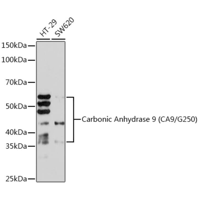 Western Blot - Anti-Carbonic Anhydrase 9/CA9 Antibody [ARC1275] (A306242) - Antibodies.com