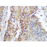 Immunohistochemistry - Anti-Carbonic Anhydrase 9/CA9 Antibody [ARC1275] (A306242) - Antibodies.com