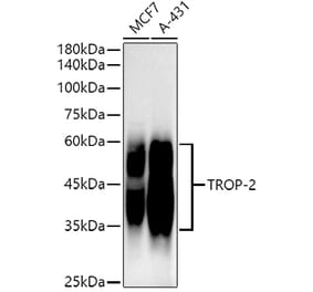 Western Blot - Anti-TROP2 Antibody [ARC51513] (A306243) - Antibodies.com